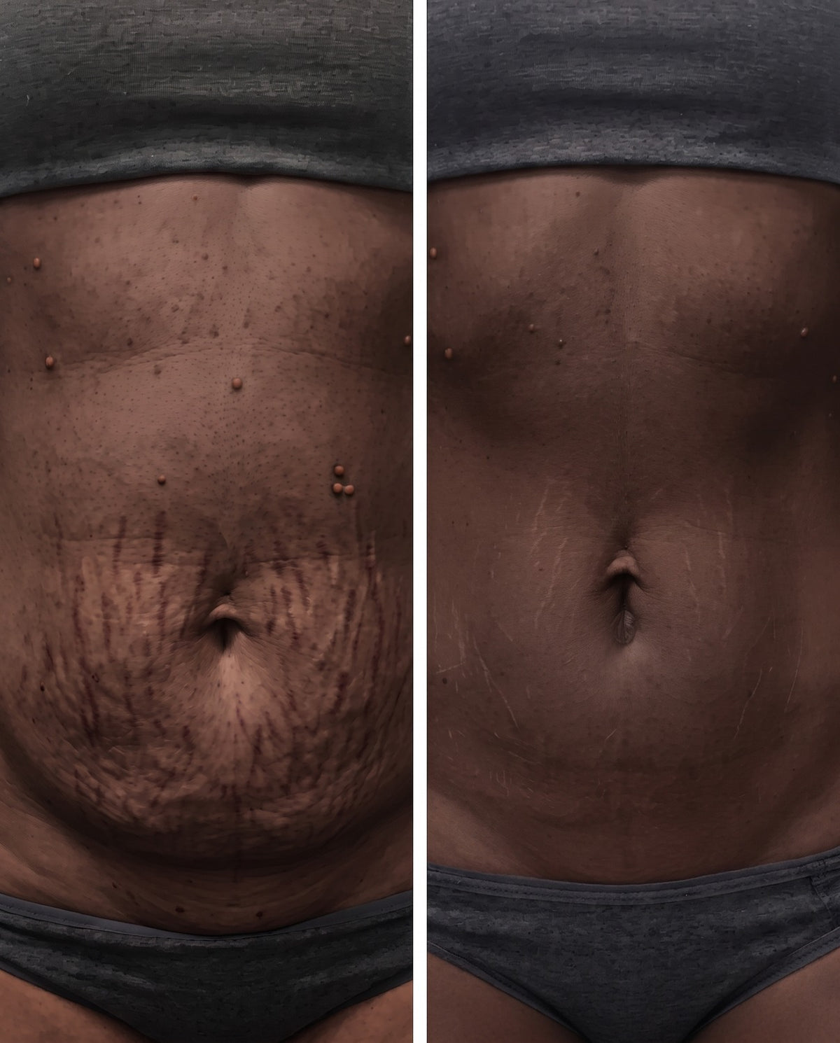 360° Sculpt Brief™ Postpartum